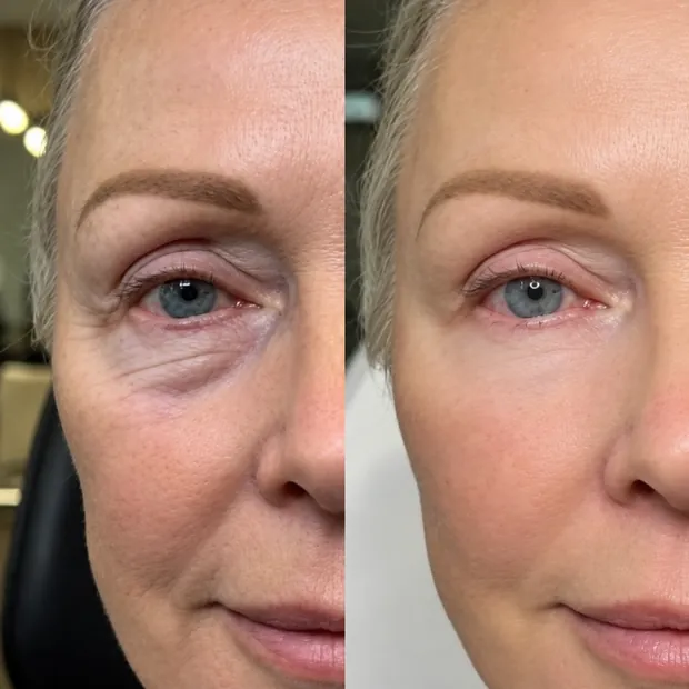 Before and after — Radiant Glow Facial